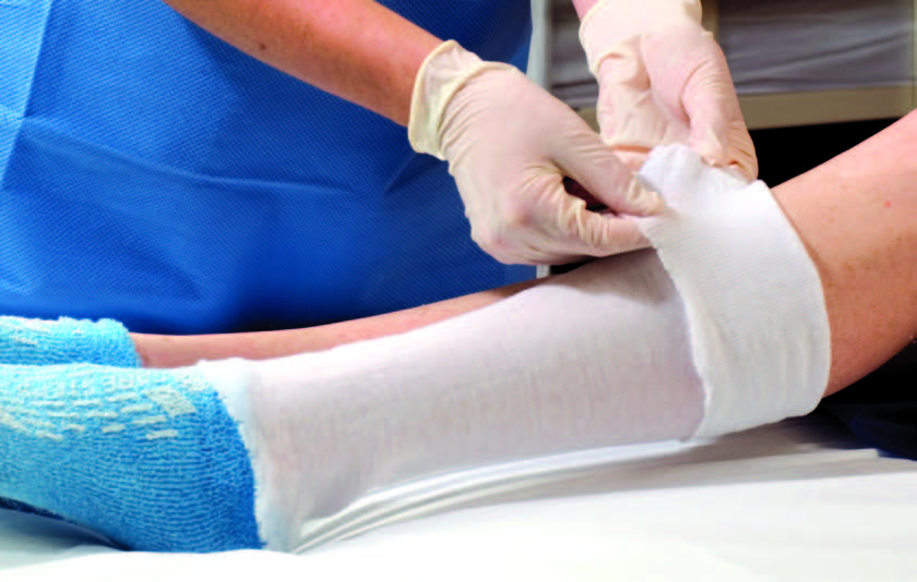 IMCO Brand Orthopedic Stockinette - Tubular, 100% Cotton, Non-Sterile, 2" x 25 yards, Not made with natural rubber latex