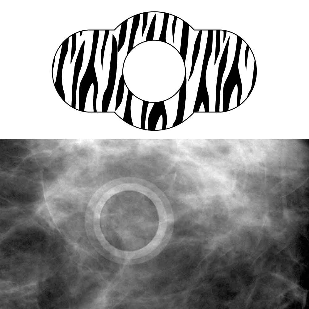 Spee-D-Ring™ Mammography Skin Marker Mole Radiolucent No Burnout™ Zebra Print 1/2" Inner Diameter - 100 per Box