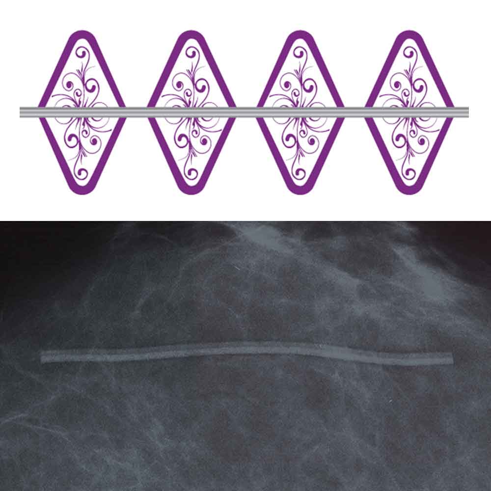 SPEE-D-LINE™ MAMMOGRAPHY SKIN MARKER SCAR RADIOLUCENT NO BURNOUT™ SWIRL COLLECTION™ SUPER-STRETCHY 1MM - 120 PER BOX